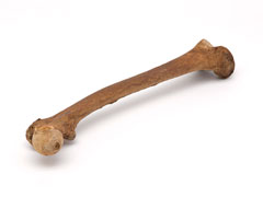 Leg bone of Lieutenant John Fraser, 1782